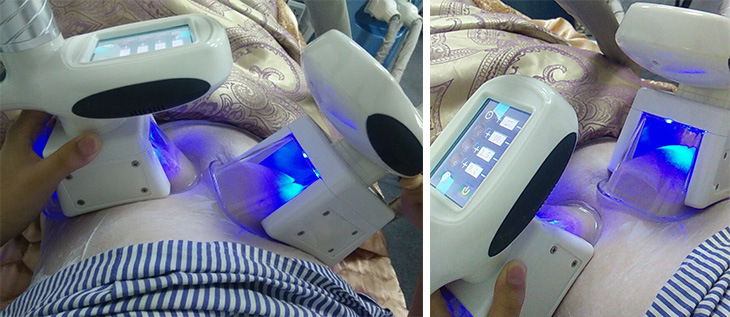 Portable Skin Rejuvenation Cavitation RF Slimming Machine Weight Loss Machine