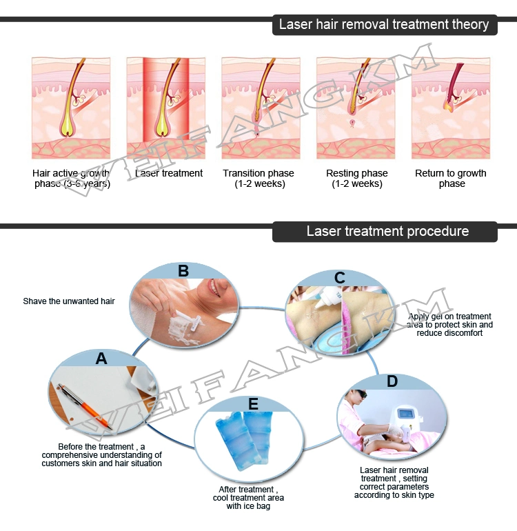 Portable 3 Wavelength 755nm 808nm 1064nm Alex Diode ND YAG Laser Hair Removal System Beauty Machine