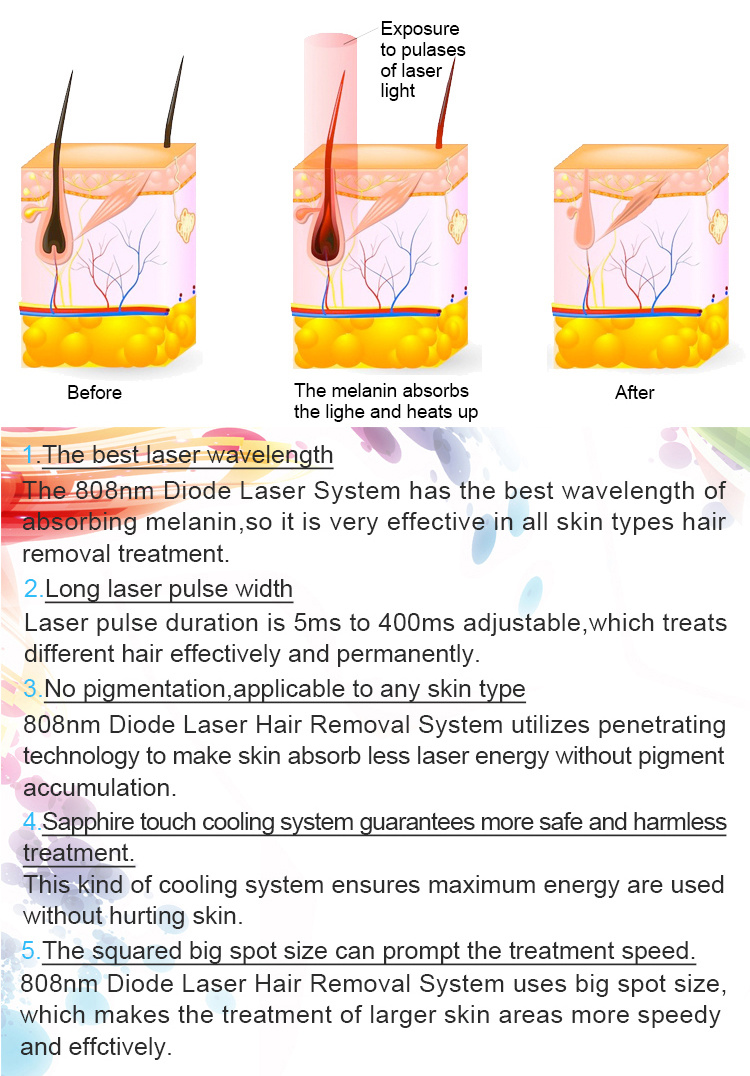 Large Spot Size 808nm Diode Laser Permanent Hair Removal Machine Diode Laser 800W