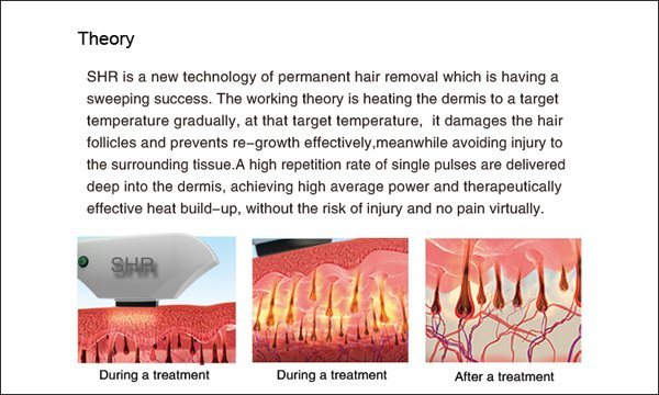 Hot Sale Shr Beauty Equipment IPL Epilator