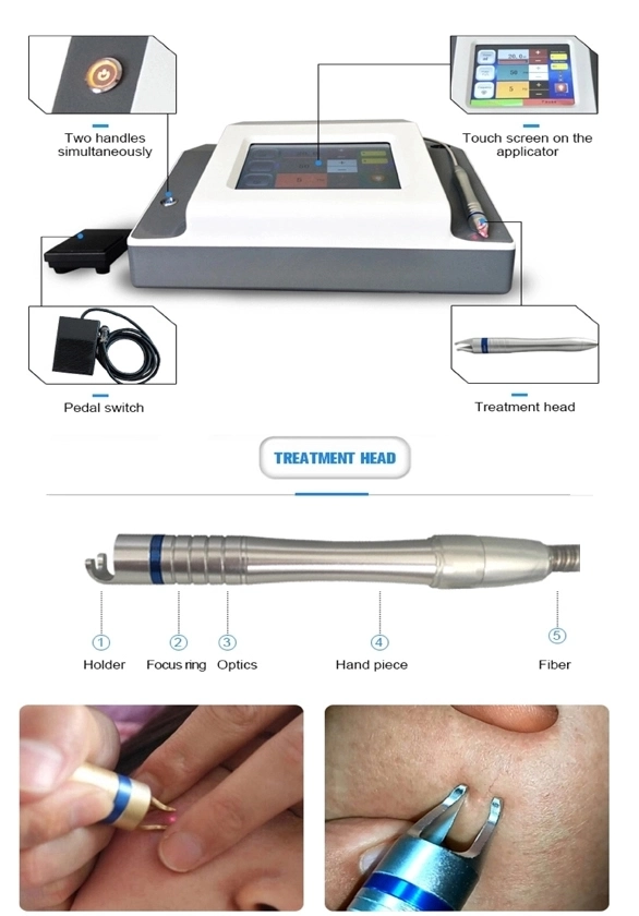 980nm Diode Laser Vascular Removal/Spider Veins Removal/Blood Vessels Removal Machine