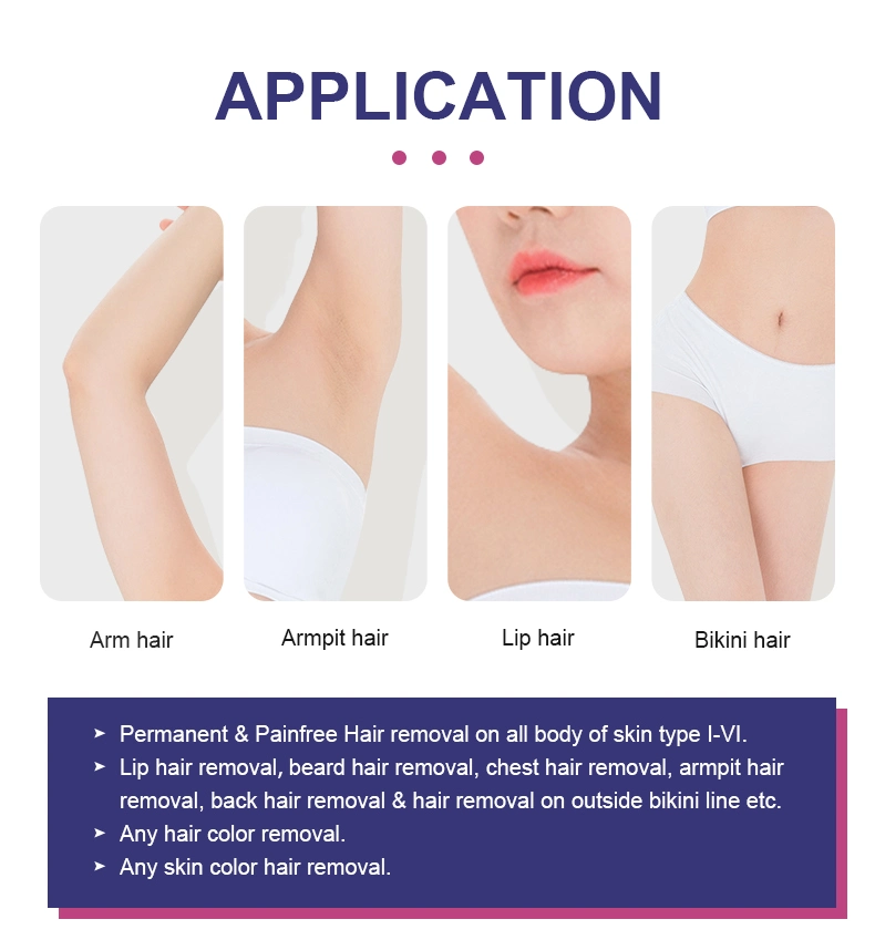 Newest Hot Sale Diode Laser 808 Remove Unwanted Hair Permanently