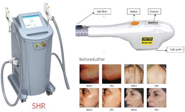 Two Handles IPL Shr / Shr Opt Hair Removal Machine with FDA Approved