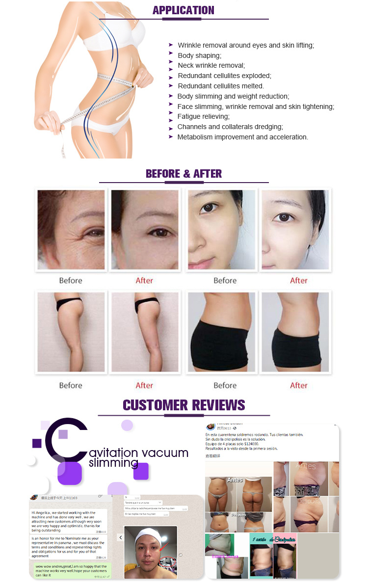 Cavitation RF Slimming Weight Loss Product for Lady Use