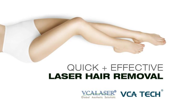 Soprano Laser Diode Vca 755 808 1064nm Diode Laser Hair Removal