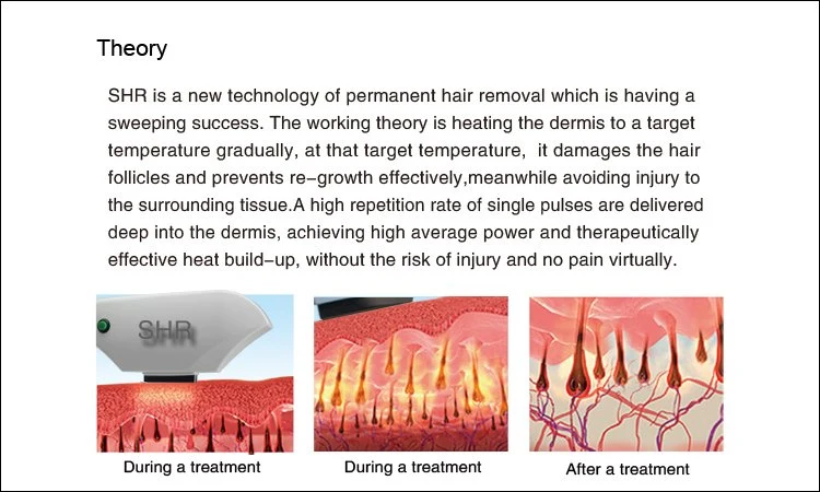 ADSS 5-in-1 Multifunctional Shr/Opt Hair Removal, Skin Rejuvenation, Acne Treatment, IPL Equipment