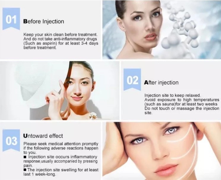 High Quality Beauty Used Facial Skineance Wrinkle Acid Hyaluronic Injection Dermal Filler