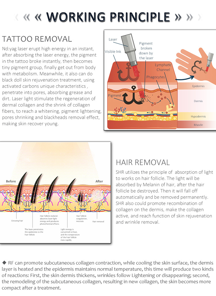 Multifunctional Beauty Instrument Hr+Elight+IPL Opt Super Hair Removal RF Light IPL Laser Machine