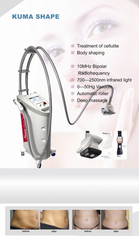 Kuma Shape 3 New Arrival vacuum Body Slimming Machine
