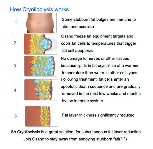 Cryolipolysis Fat Freezing Slimming Machine RF Lipo Laser Machine