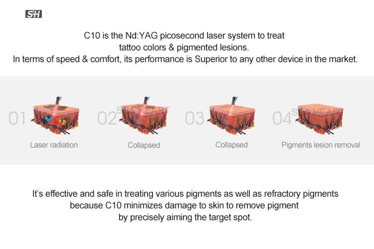 China Picosecond Q Switch ND: YAG Laser Vertical for Tattoo Removal, Age Pigment & Freckle Removal
