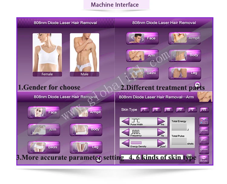 Germany Quality The Best Diode Laser Hair Removal/Diode Laser