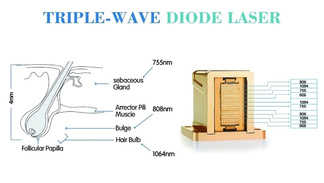 High Power Most Professional Triple Wavelength Hair Removal 755nm 808 1064nm Diode Laser Machine