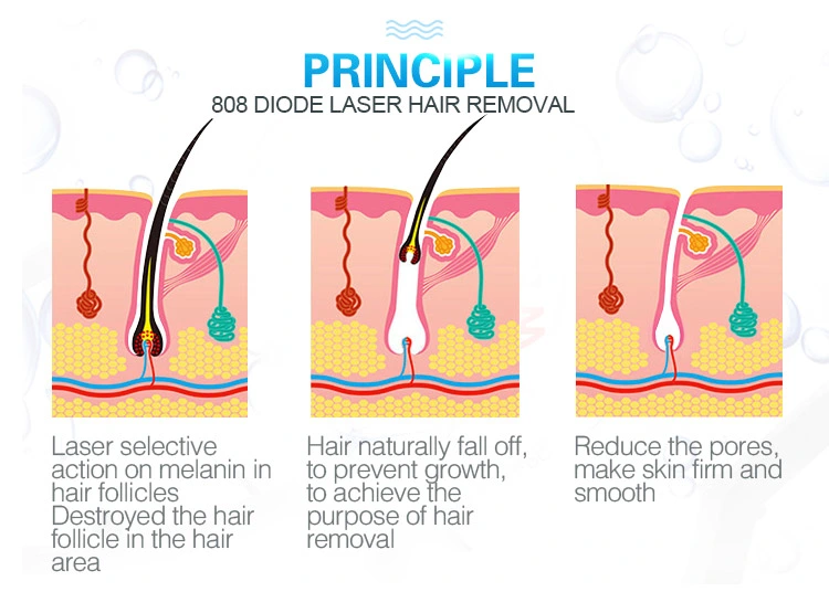 Triple Wave 808nm 1064nm 755nm Laser Diode Harmony XL PRO Flawless Painless Hair Removal Laser Device