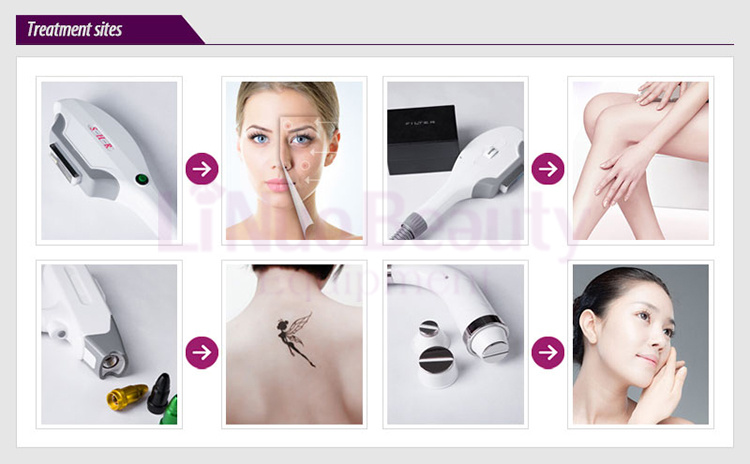 IPL Shr Hair Removal E-Light Hair Removal Machine