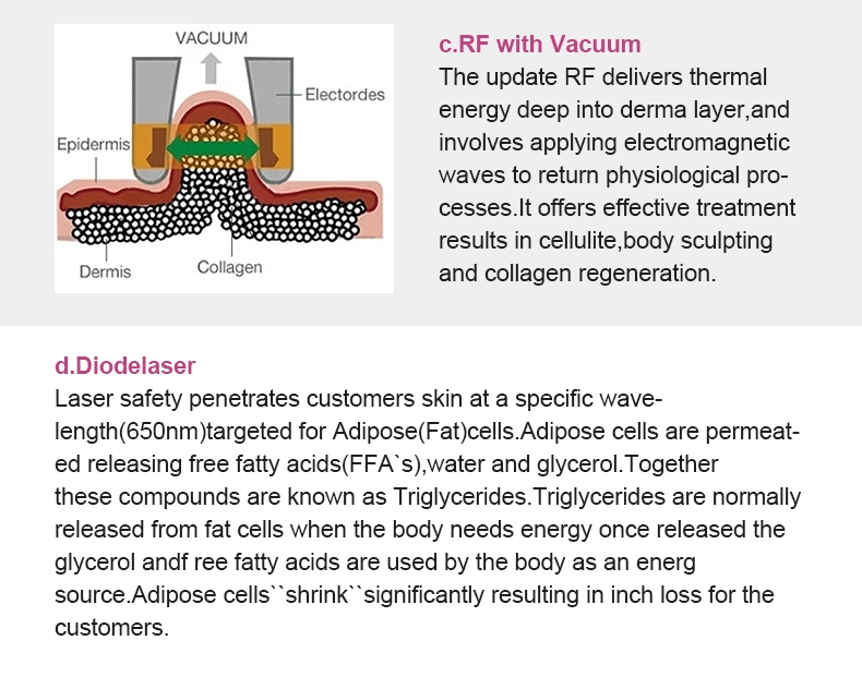 40K Home Use/Weight Loss/Cavitation+RF+Vacuum/RF Cavitation Vacuum Lipo Laser Slimming Machine