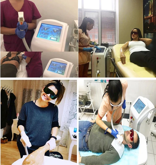 Hot Stationary 808 Nm Diode Laser Hair Removal Machine Soprano Ice Alexandrite Laser Top Seller 2021