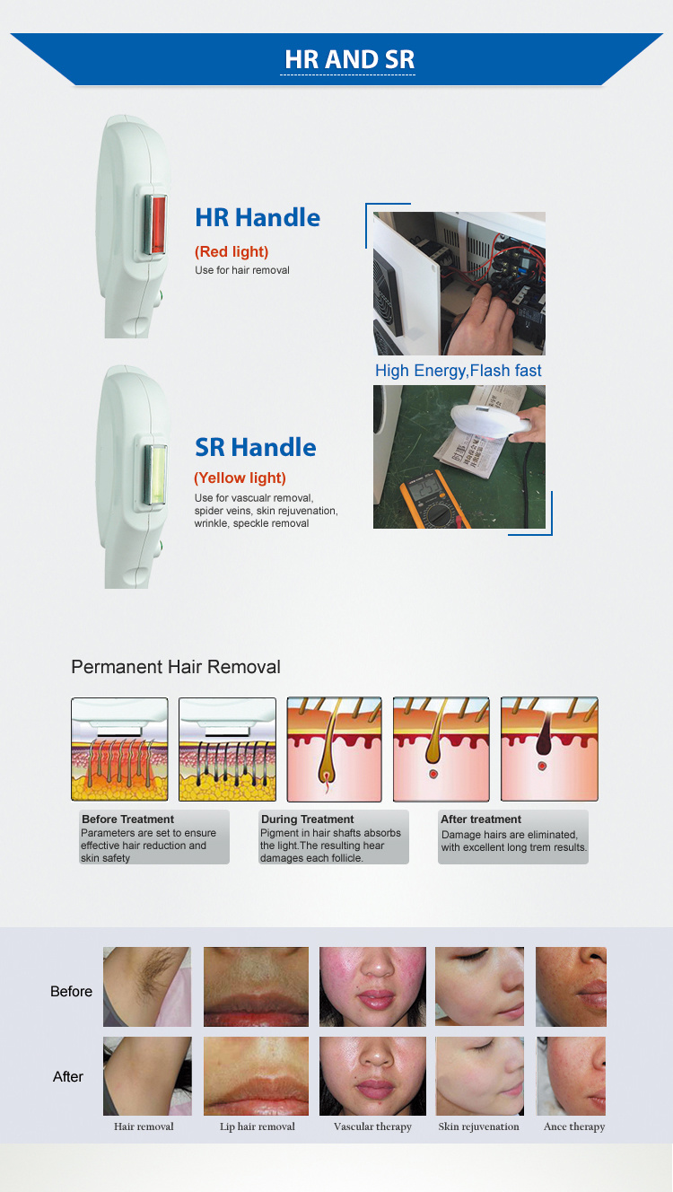 Customize 2 Handles Hair Removal Shr IPL Elight Machine Skin Rejuvenation