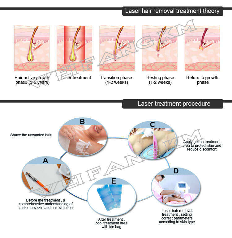 Vertical Laser Hair Removal Device 808nm Diode Laser