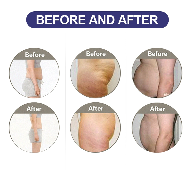 Newest Beauty Multifunctional Skin Care Face Arm Leg Waist Skin slimming Massager Equipment for Salon