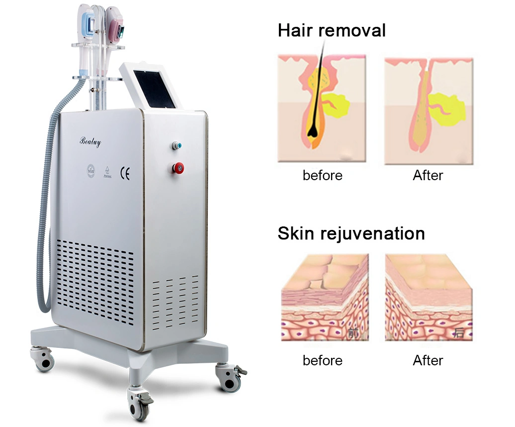 Double Handle Multifunction 360 Magneto-Optic Shr Hair Removal Beauty Machine