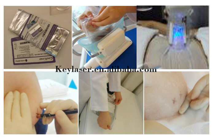 Four Handpiece Cryolipolysis Slimming Cellulite Reduce Machine Skin Care Body Slimming