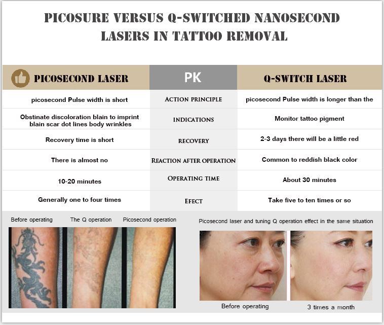 Best Seller Picosure Q-Switched ND YAG Laser Tattoo Removal Machine