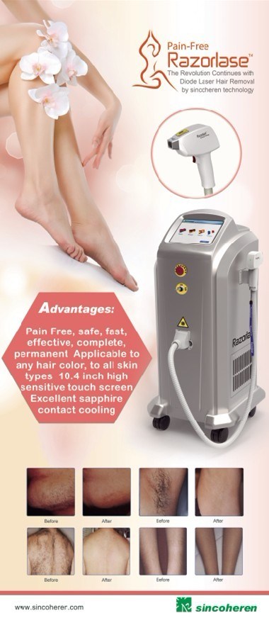 Ce FDA Approved Professional Diode Laser Hair Removal Machine