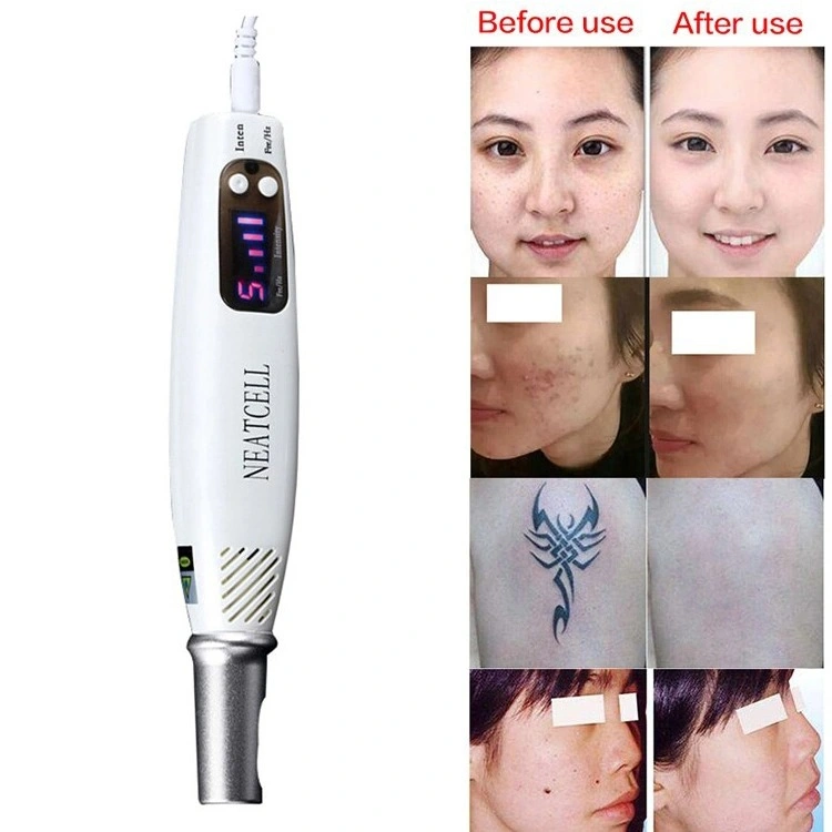 Portable Picosecond Laser Pen for Tattoo Spot Freckle Removal 755nm Laser