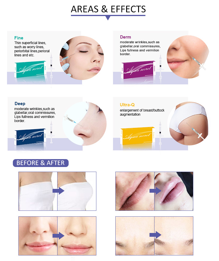 Hyaluronic Acid Beauty Derm Filler for Skin