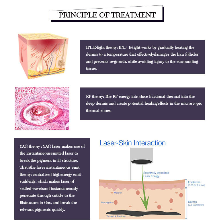 Hotest Shr Depilation Elight IPL+RF+E-Light+ND YAG Laser