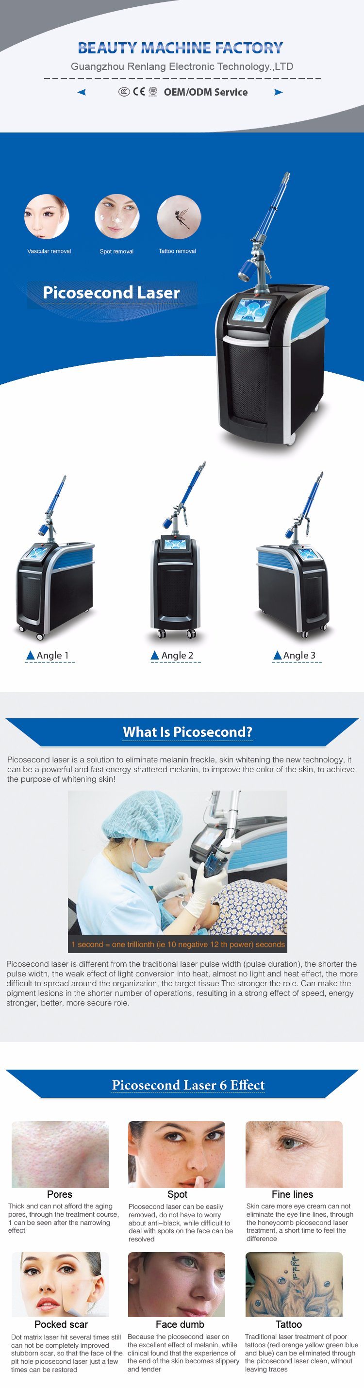 Disributor Price 755nm Unique Design Picosecond Laser Machine