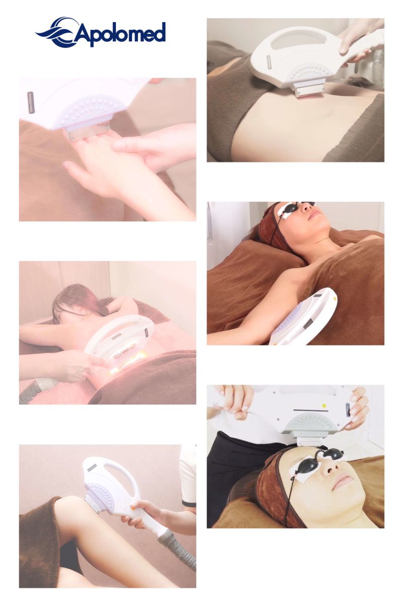 IPL Shr Hair Removal Machine Laser Beauty Equipment