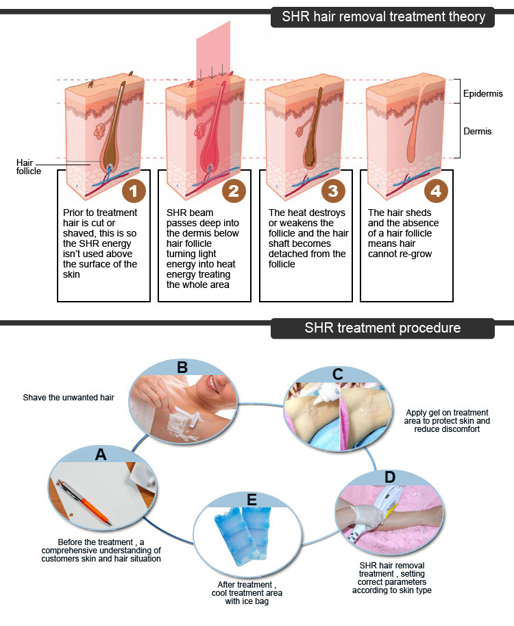 Aesthetic Machine Opt Shr Depilation IPL Hair Removal