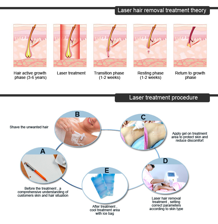 Medical Ce Laser Epilation 808 755 1064nm / Triple Wavelength Diode Laser