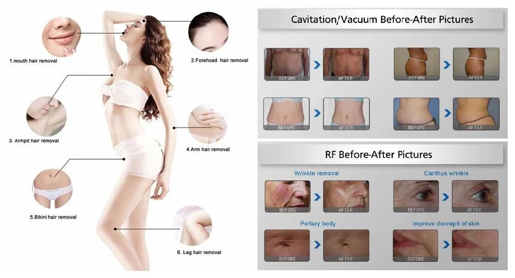 Cavitation RF Vacuum Slimming/Ultrasonic Cavitation/Slimming Cavitation Machine for Sale