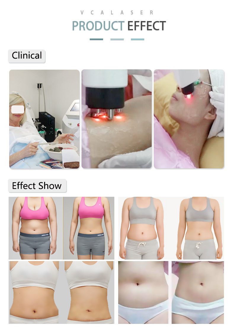 Cavitation Tripolar RF Laser Slimming 4 in 1 Beauty Equipment