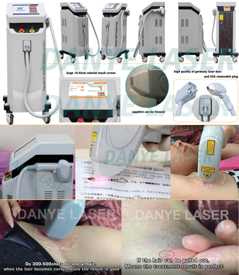 Professional Big Spot Size 808nm Diode Laser Hair Removal Machine