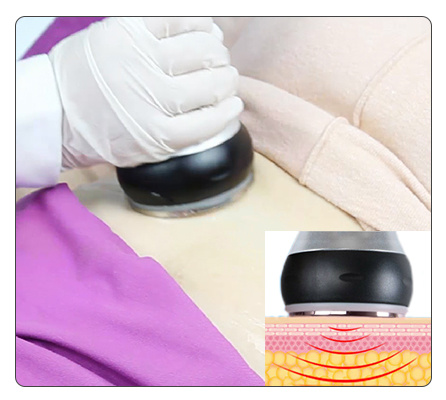 Ultra RF Beauty Ultrasonic Liposuction Cavitation Lipo Slimming Machine