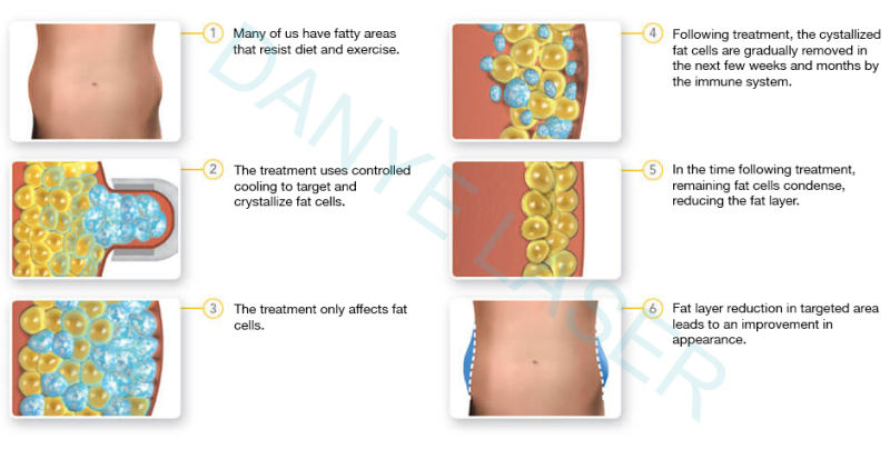 360 Freeze Cryo Cavitation RF Slimming Machine