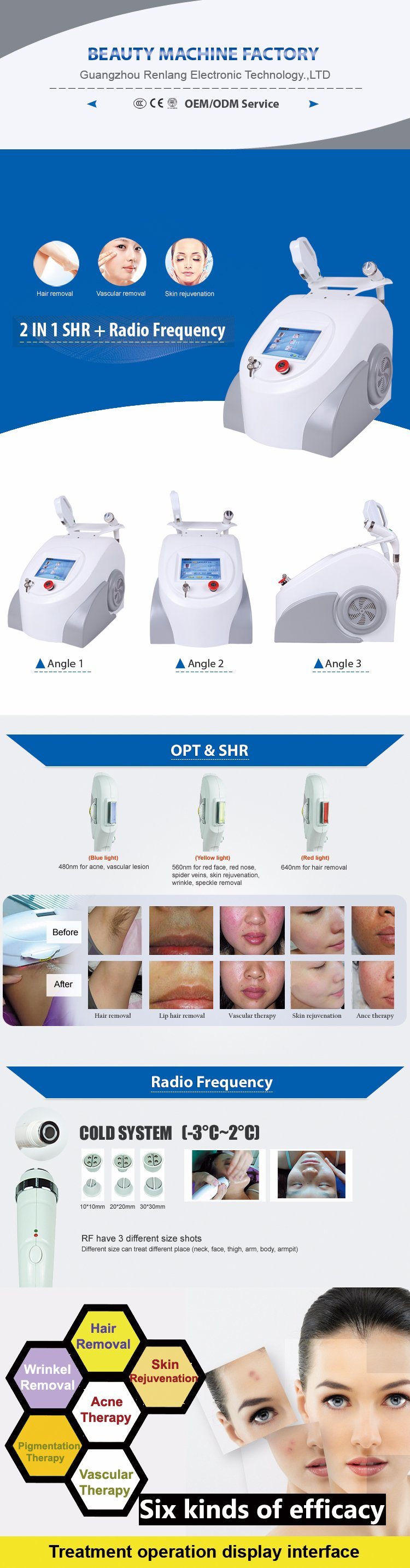 Portable Tattoo/Hair Removal IPL Laser Medical Equipment