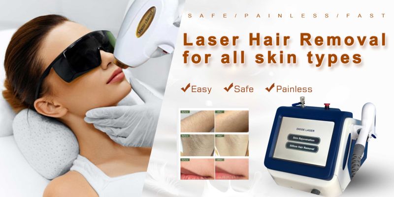 755nm Alexantrite 1064nm Ndyag Painless Epilator 808nm Diode Laser