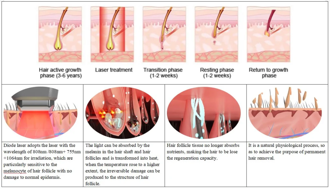 Permanent Hair Loss Diode 808nm Hair Removal Laser Diode with TUV Ce