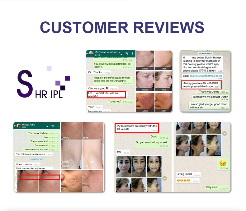 IPL Skin Rejuvenation Machine Shr Hair Removal Opt/ Filter Handle Shr Elight Hair Removal Equipment