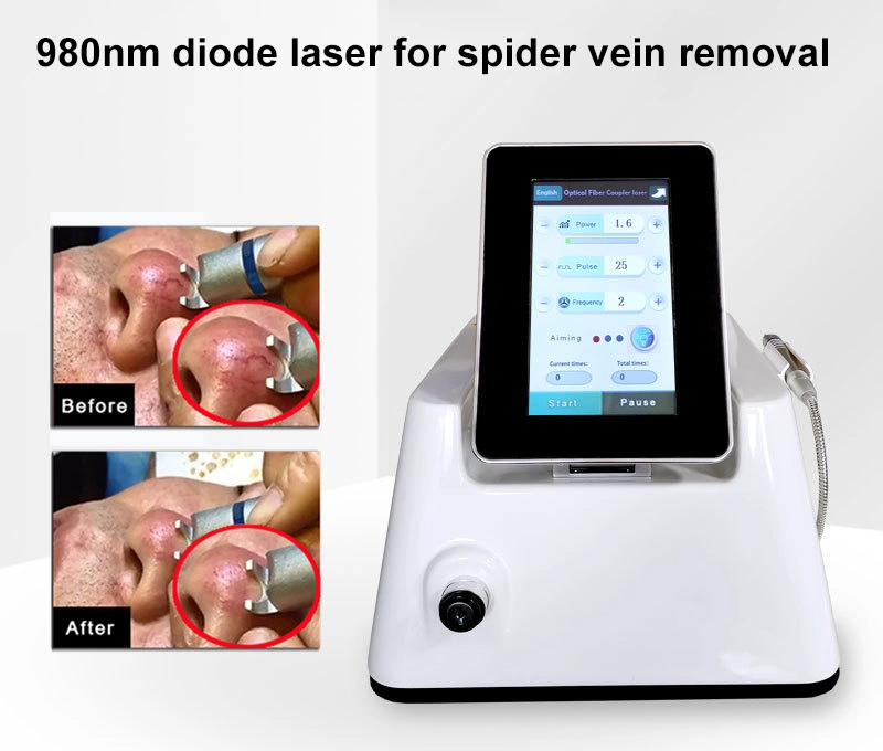 980nm Diode Laser Vascular Removal Machine / Vein Removal Vascular Laser 980 Nm