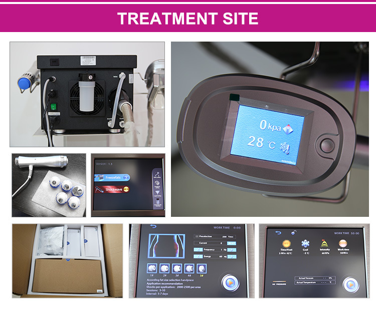 CE Certificate Low-Energy Extracorporeal Shockwave Pain Treatment Therapy Fat Freezing Equipment Price