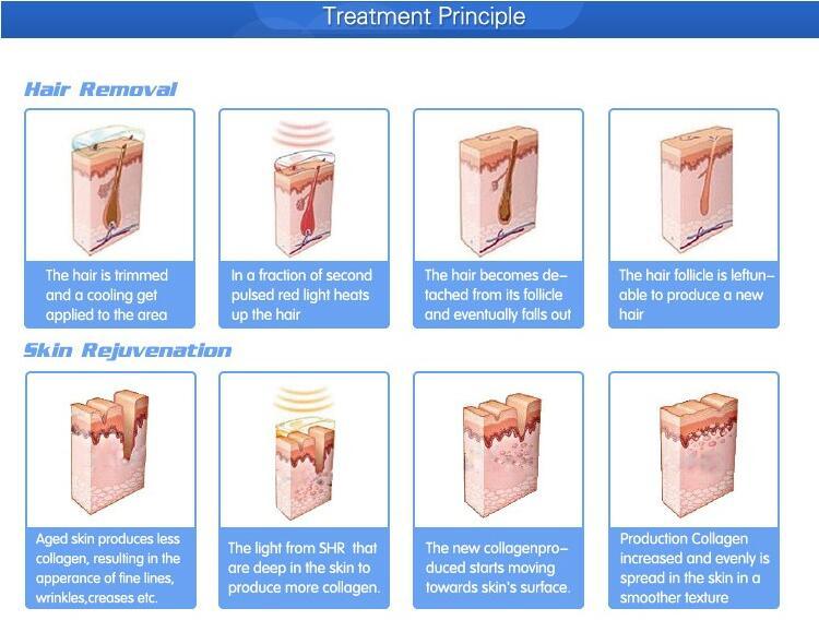 Professional Device Beauty Machine Diode IPL Shr Elight Laser Hair Removal