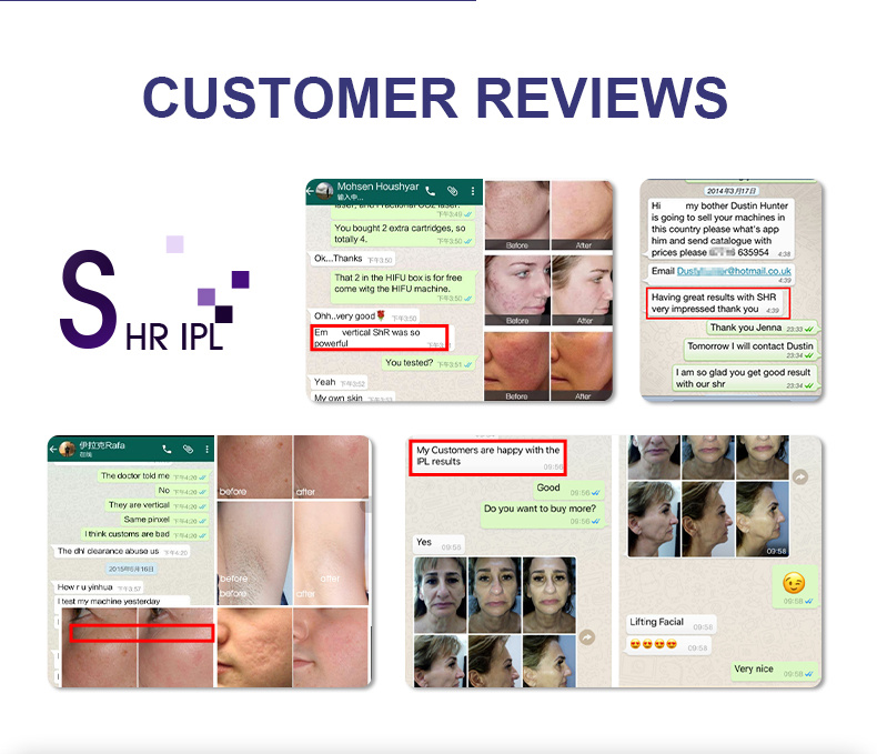 World-Top Class IPL Elight Shr Super Hair Removal Multifunctional IPL Laser Equipment