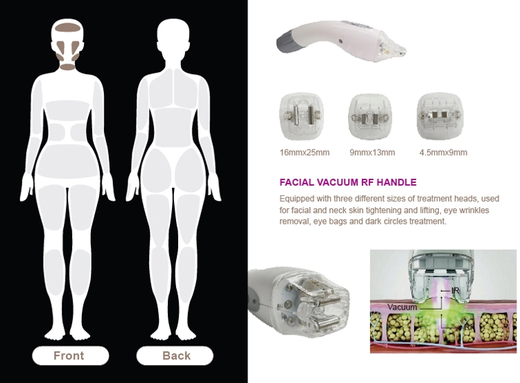 Vacuum Suction Real Professional RF Slimming Machine Full Body Treatment Velashape for Body Face Eyes Treat