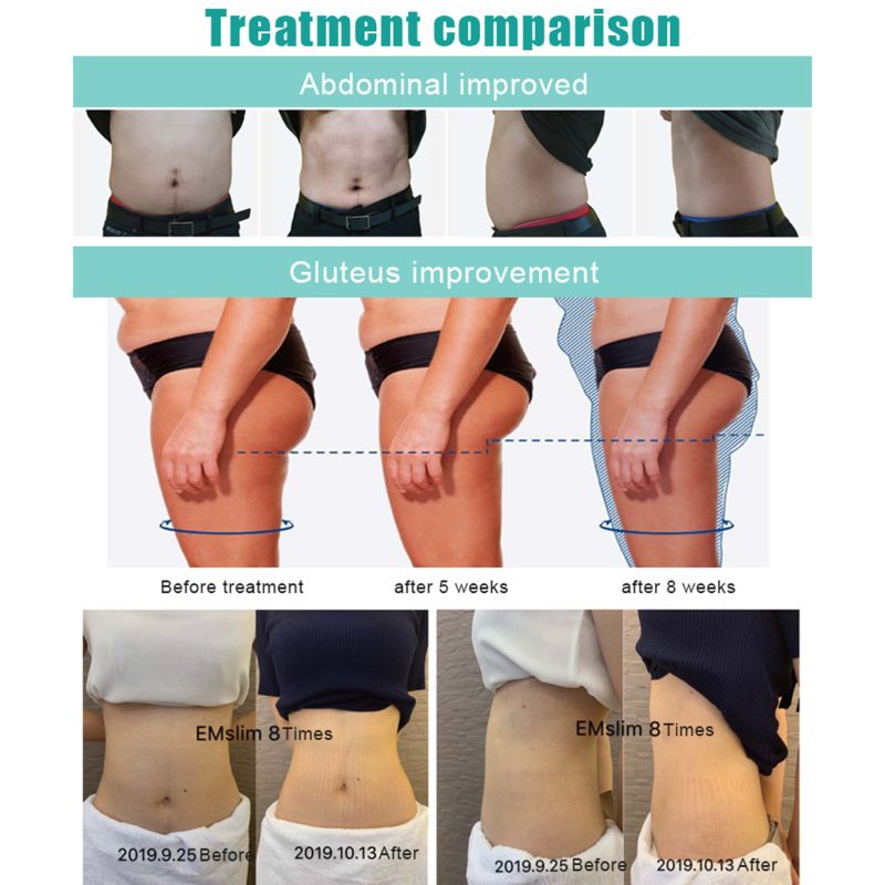 IN-M119 Fat Reduction Treatment Non Surgical Body slim beauty machine